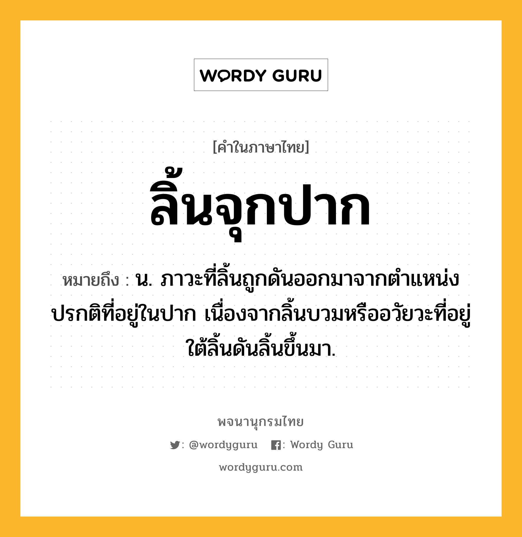 ลิ้นจุกปาก ความหมาย หมายถึงอะไร?, คำในภาษาไทย ลิ้นจุกปาก หมายถึง น. ภาวะที่ลิ้นถูกดันออกมาจากตำแหน่งปรกติที่อยู่ในปาก เนื่องจากลิ้นบวมหรืออวัยวะที่อยู่ใต้ลิ้นดันลิ้นขึ้นมา.